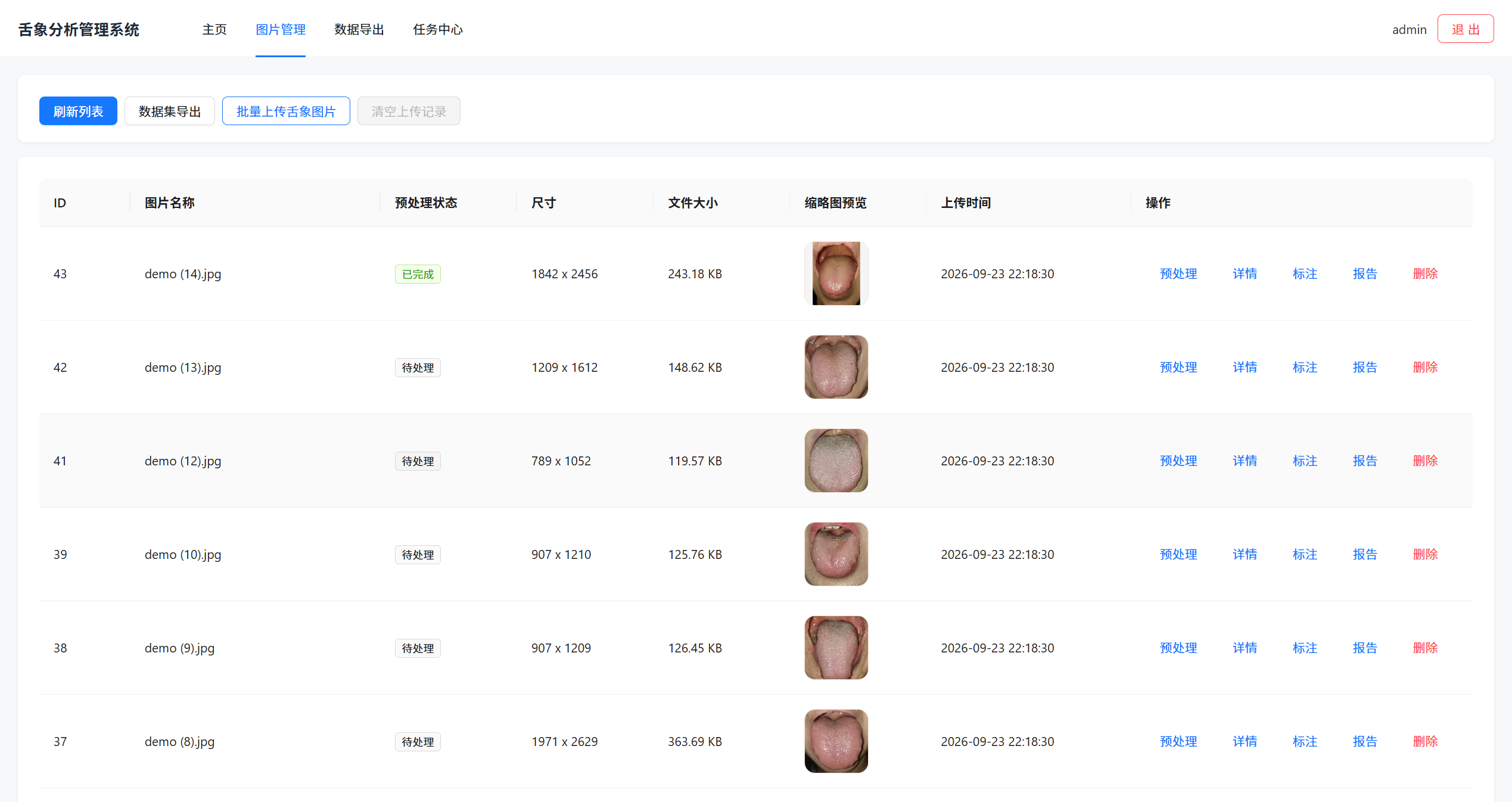 舌象原图批量采集与 OpenCV / Pillow 标准化预处理中台